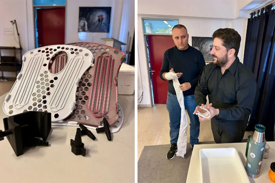 El Hospital Justo José de Urquiza explora impresión 3D para innovar en tratamientos médicos