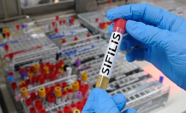 La sífilis se dispara en Bahía con un crecimiento del 88% en el último período