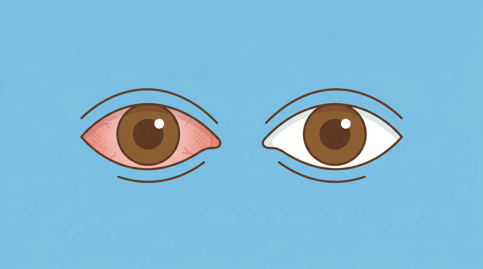 Los riesgos ocultos de rascarse los ojos y cómo afecta la salud visual
