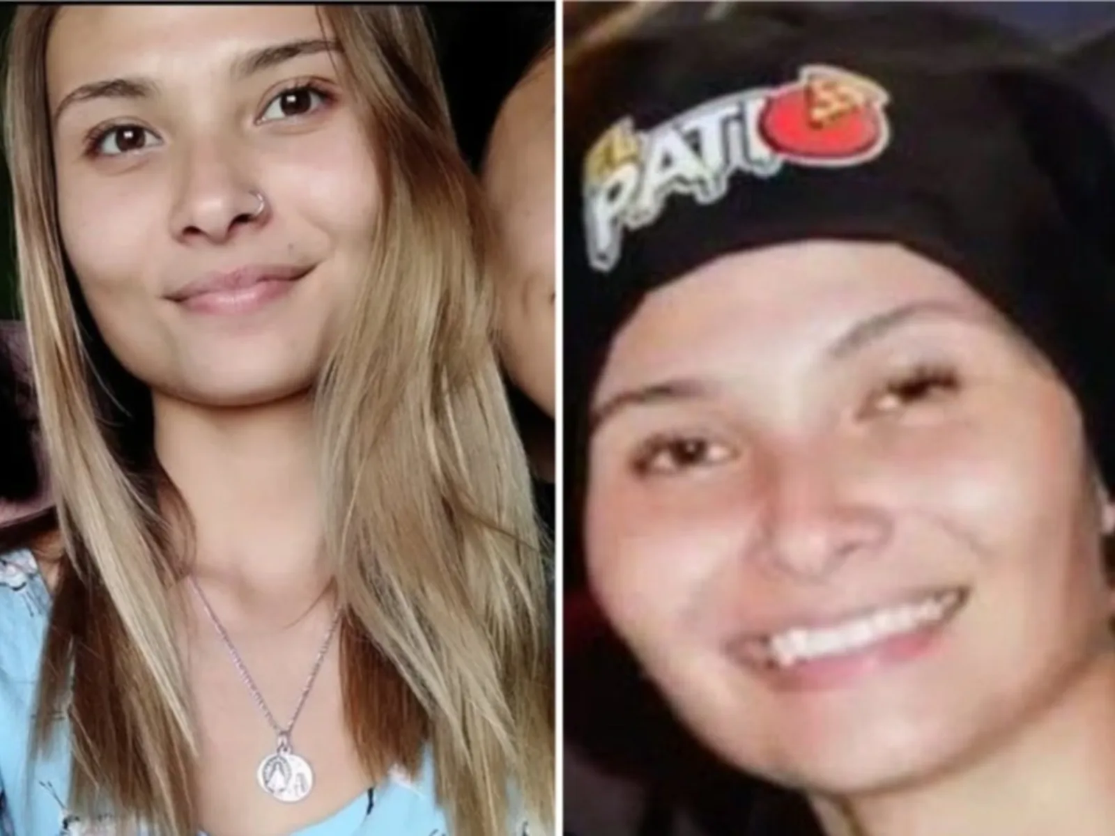 Murió una joven tras un mes de agonía con quemaduras que cubrían el 80% de su cuerpo
