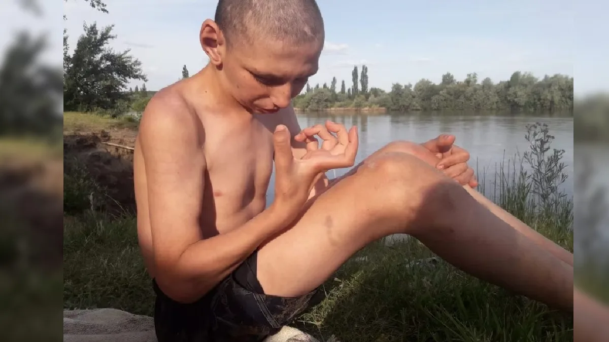 Tiene 21 años, mide 2,50 y lucha por recuperar la capacidad de caminar