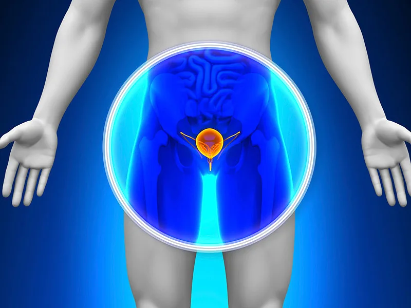 Cáncer de próstata en Argentina: la importancia de la detección temprana para salvar vidas