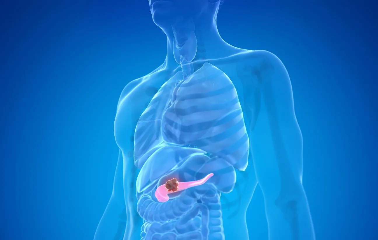 Daraxonrasib prolonga la supervivencia en cáncer de páncreas y abre nuevas esperanzas para otros tumores