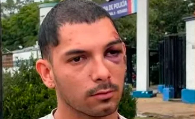 Joven agredido tras discusión busca testigos para presentar pruebas en la Justicia